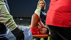 Cựu thủ môn Barca phải phẫu thuật khẩn cấp vì... thủng ruột