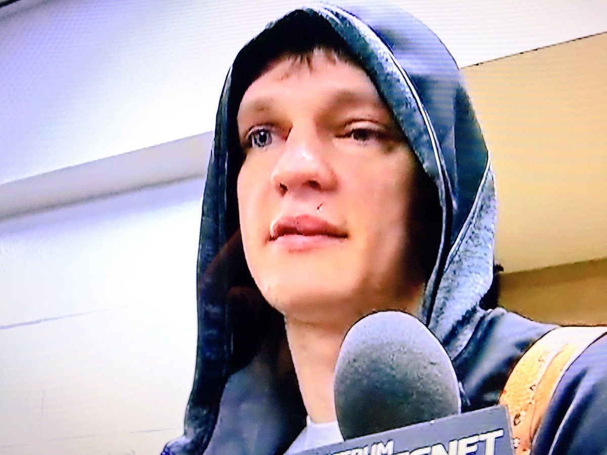 Khuôn mặt sưng húp của Mozgov sau trận đấu với Pacers