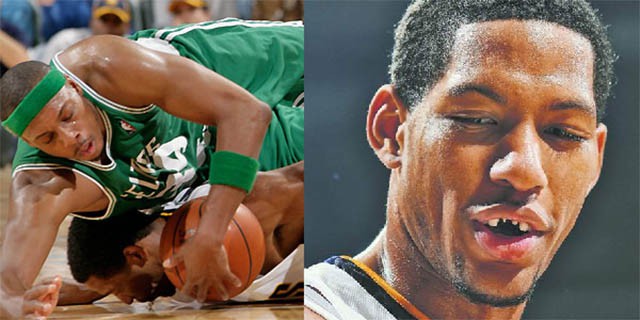 Danny Granger ngã đập mặt xuống sân