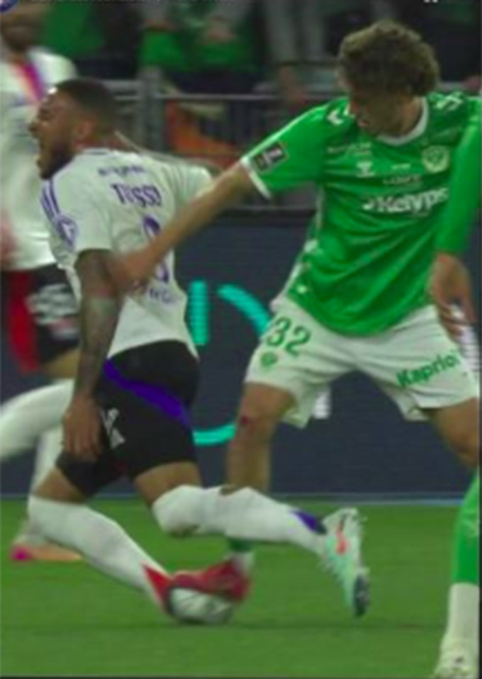 Tolisso bị phạm lỗi thô bạo và phải rời sân, nhưng Stassin chỉ bị thẻ vàng